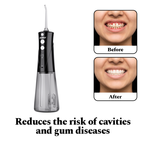 Power Dental Flosser